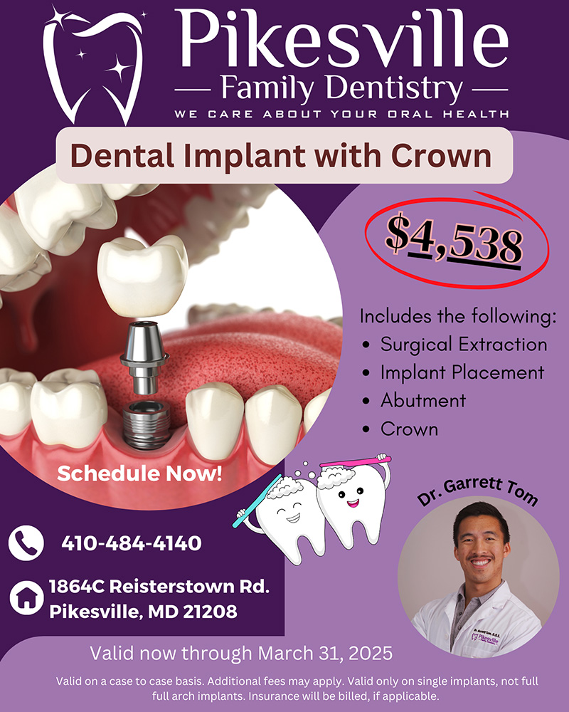 Pikesville Family Dentistry | Pediatric Dentistry, Emergency Treatment and Crowns  amp  Caps