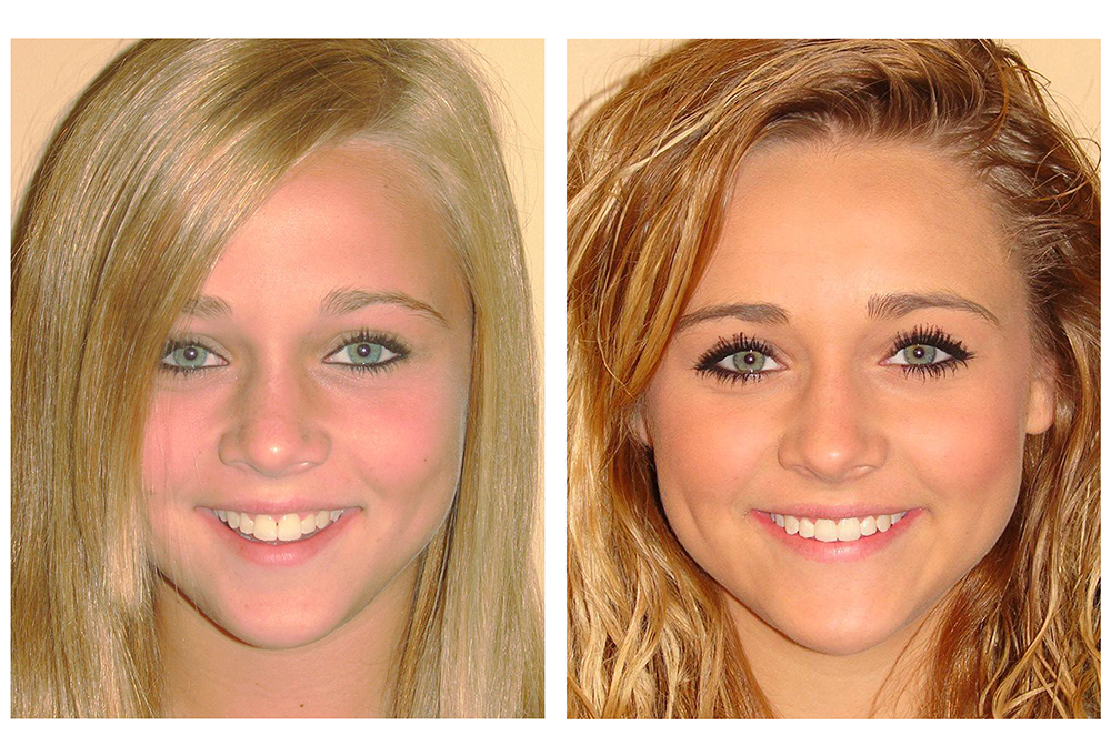 Pikesville Family Dentistry