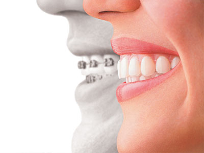 Pikesville Family Dentistry | Dental Fillings, Dental Bridges and Crowns  amp  Caps