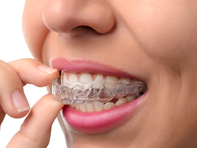 Pikesville Family Dentistry | Emergency Treatment, Dentures and Oral Cancer Screening