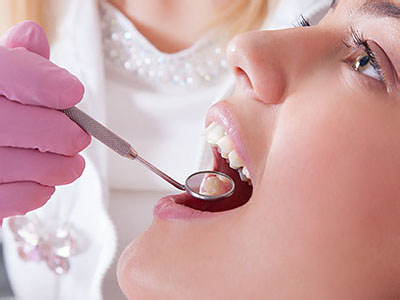 Pikesville Family Dentistry | Oral Cancer Screening, Dental Fillings and Pediatric Dentistry